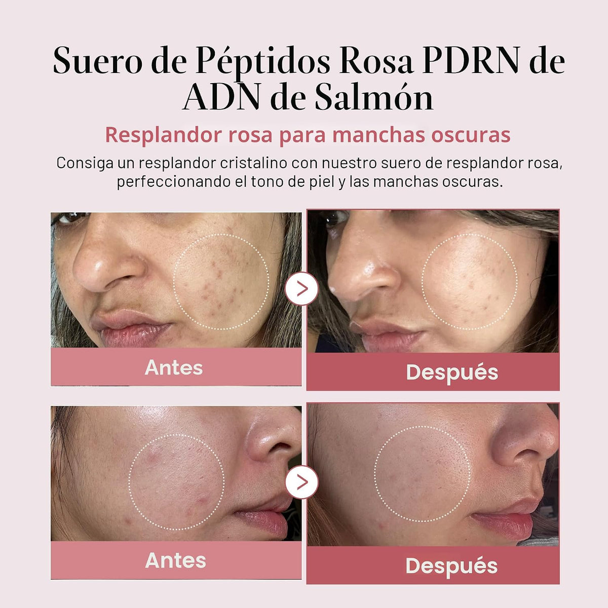 medicube Dúo de suero viral para piel clara y regordeta: suero rosa...