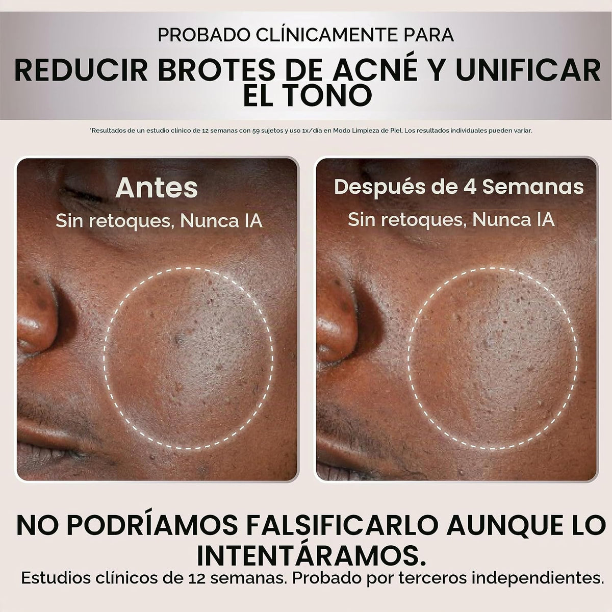 Mascarilla facial LED Shark CryoGlow, terapia de luz roja, enfriami...