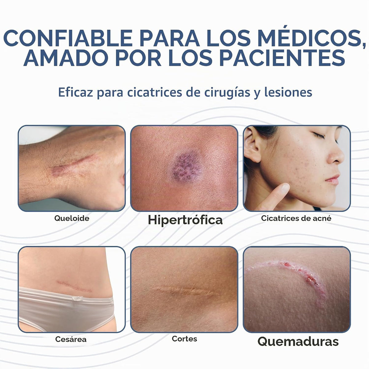 Biodermis Pro-SIL - Barra de gel de silicona para cicatrices, cuida...