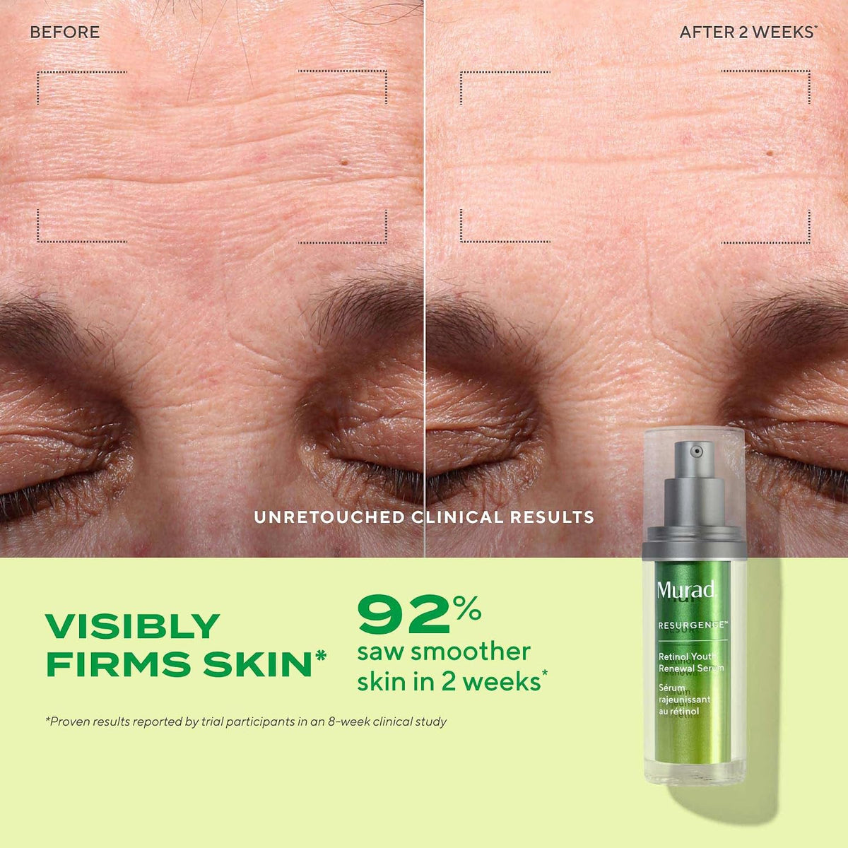 Murad Retinol Youth Renewal Serum - Suero de retinol de acción rápi...