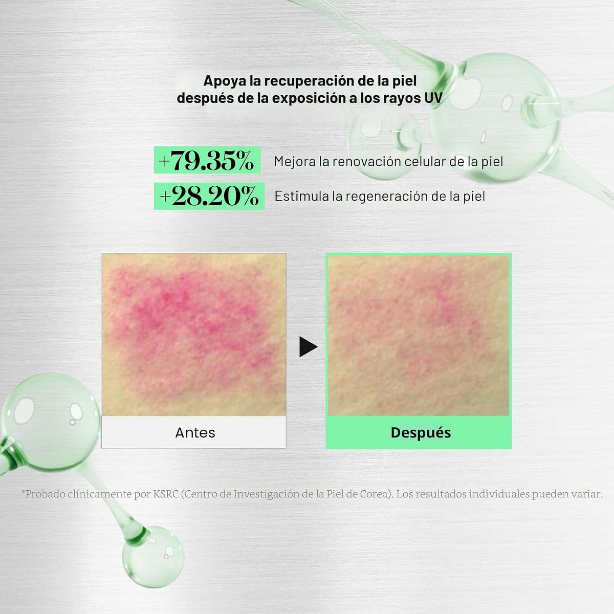 VT COSMETICS CICA Reedle Shot 700, suero de microagujas con espícul...