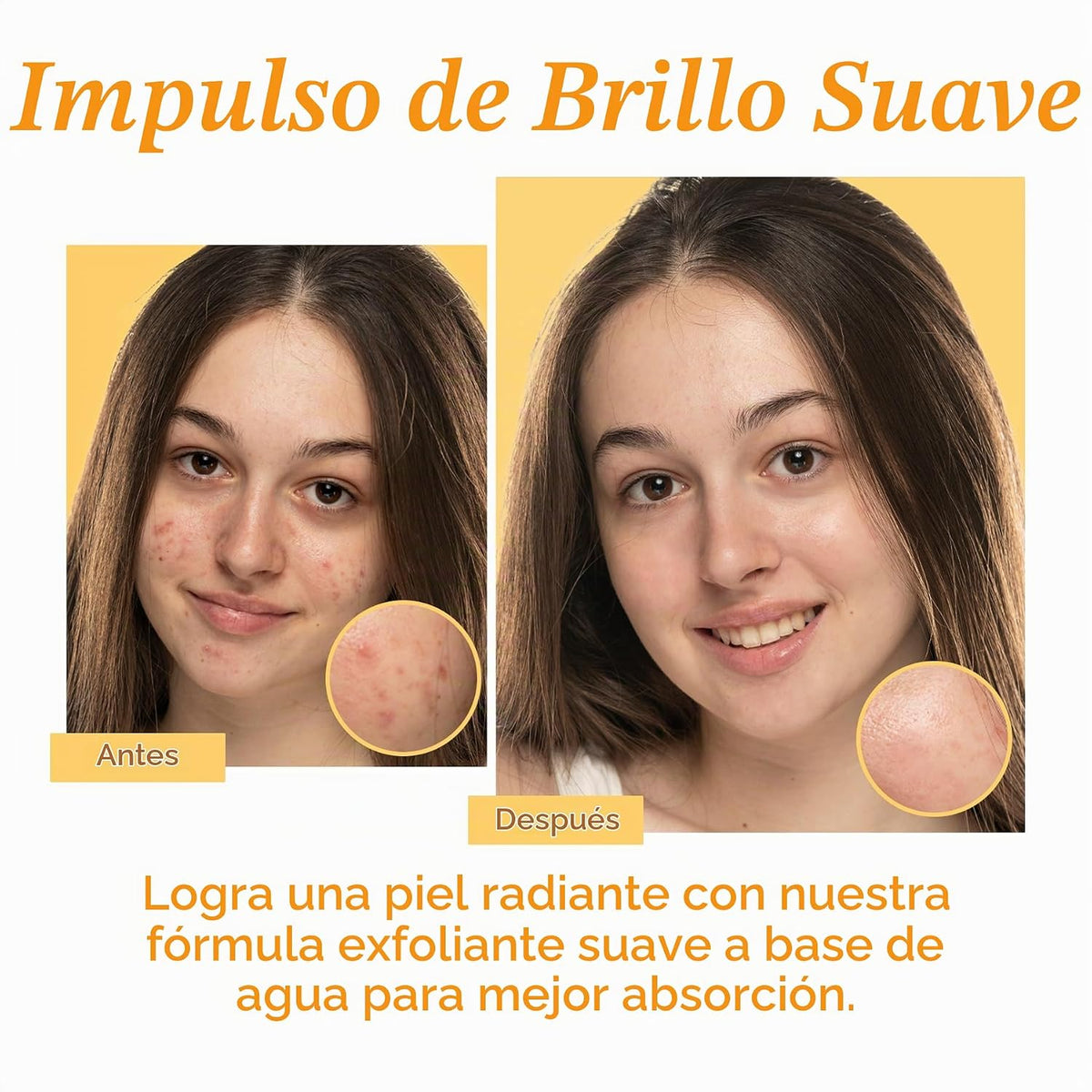 Tree To Tub Suero de ácido mandélico, 10% suave exfoliante AHA suer...