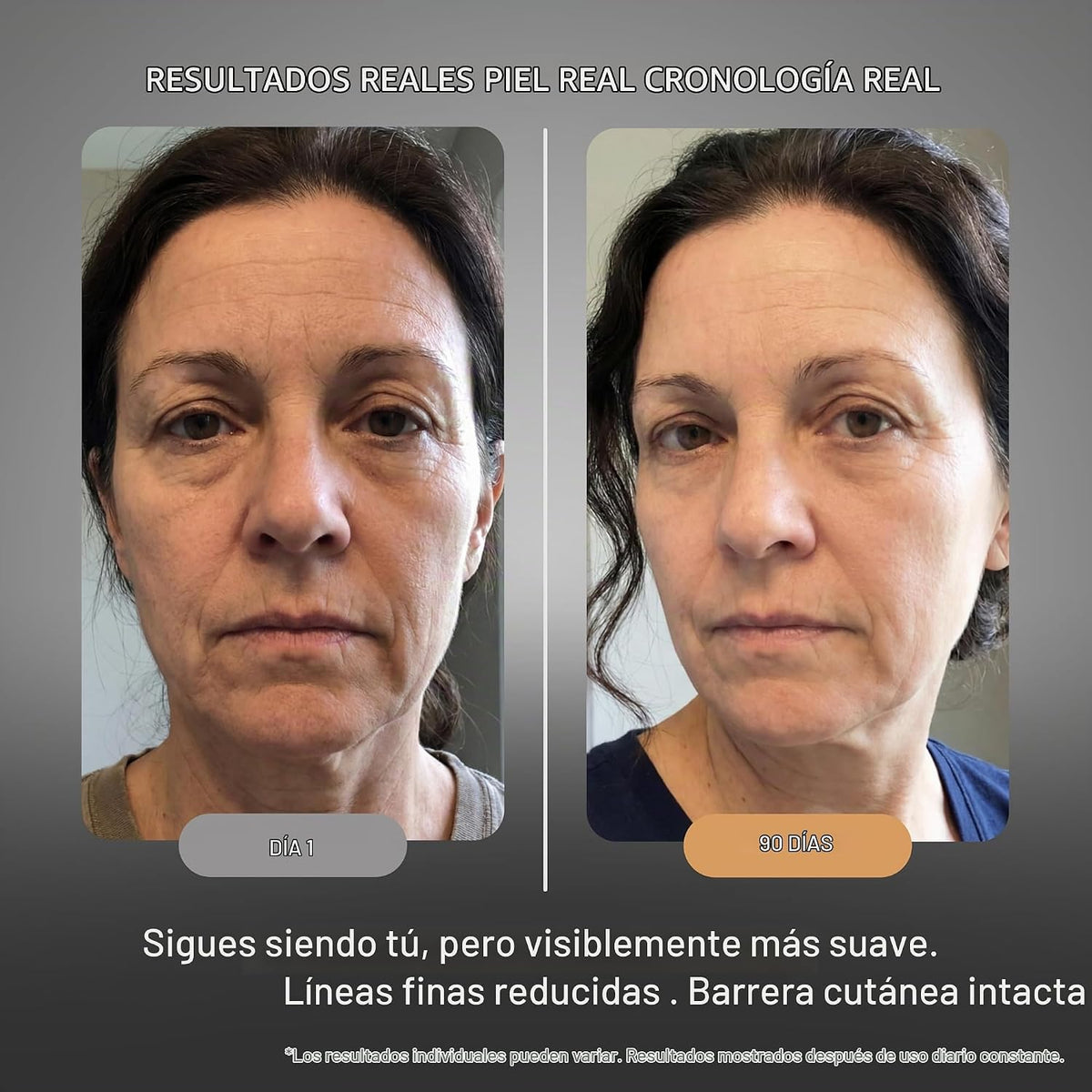 Suero de retinol para arrugas faciales \u2013 Sistema renovador de...