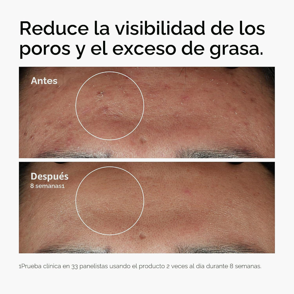 The Ordinary Niacinamida 10% + Zinc 1%, sérum suavizante para piele...