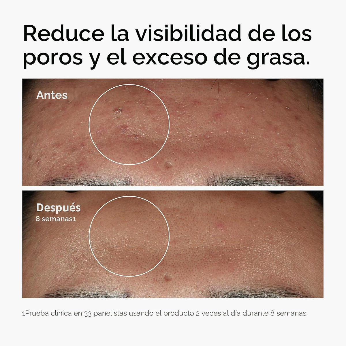 The Ordinary Niacinamida 10% + Zinc 1% - Sérum