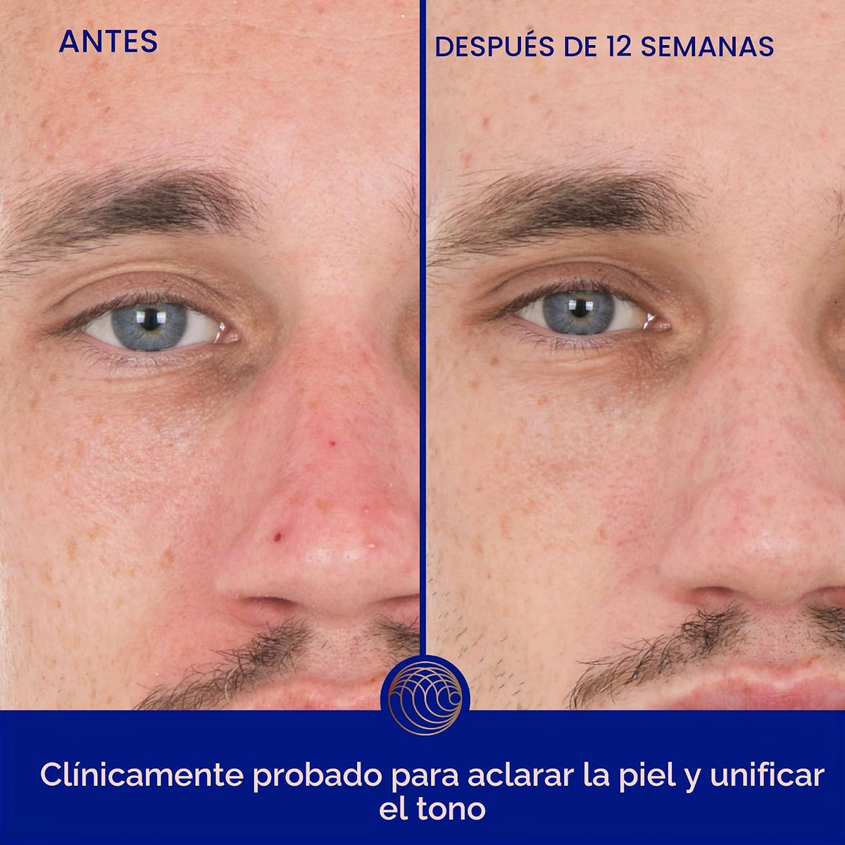 El suero de retinol