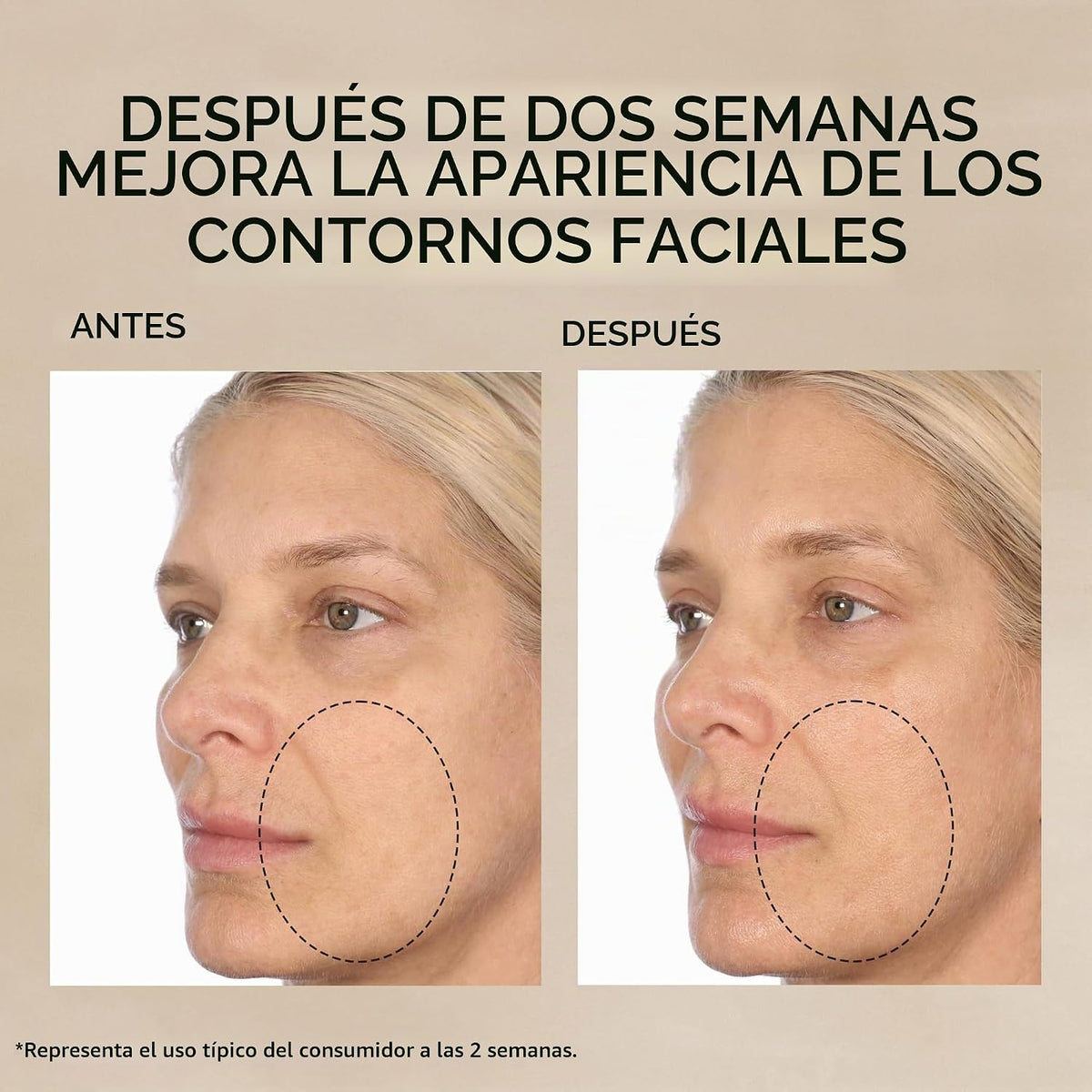 Cápsulas de suero facial de retinol + HPR de ceramidas de Elizabeth...