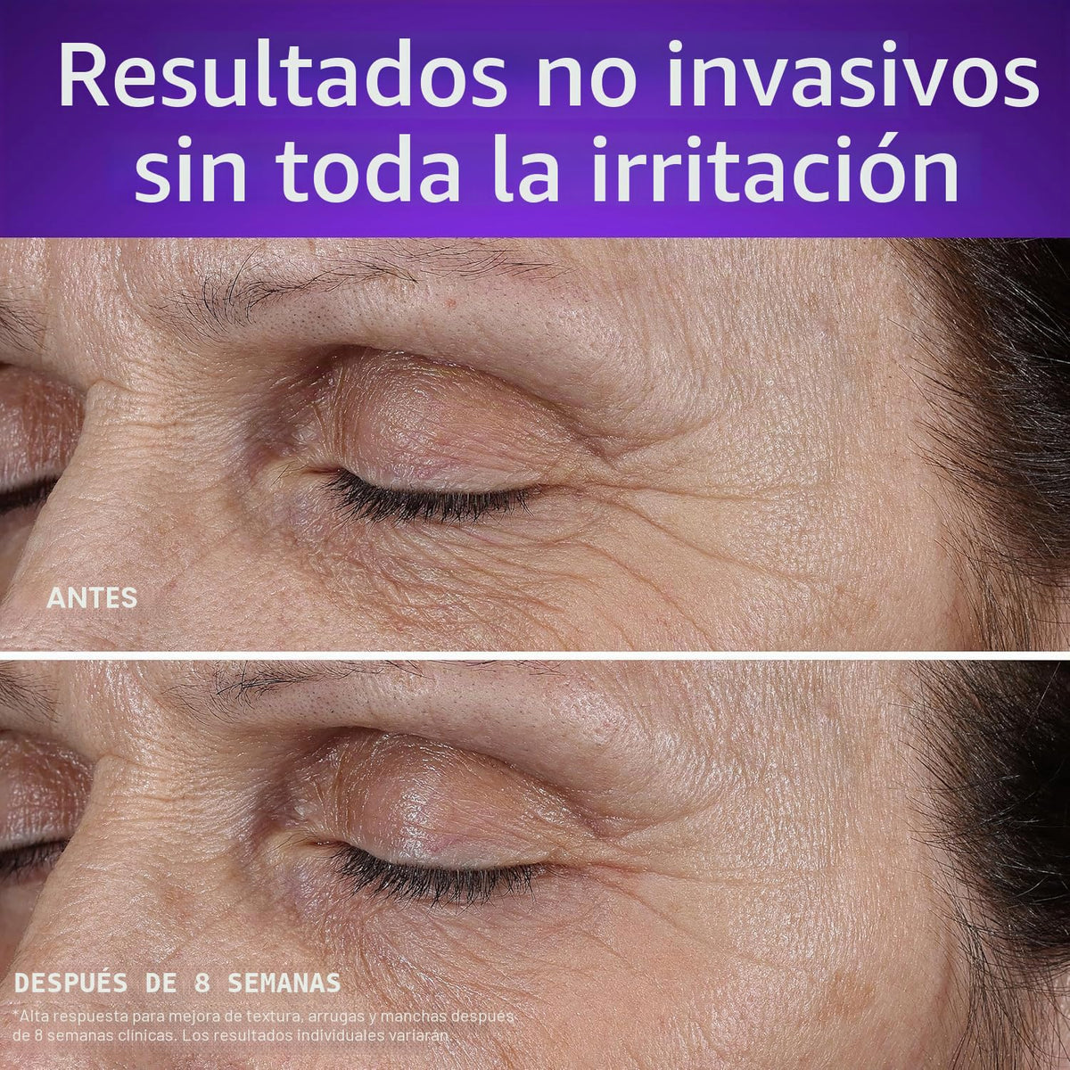 Olay Crema de noche de retinol para mujeres, MAX, hidratante facial...