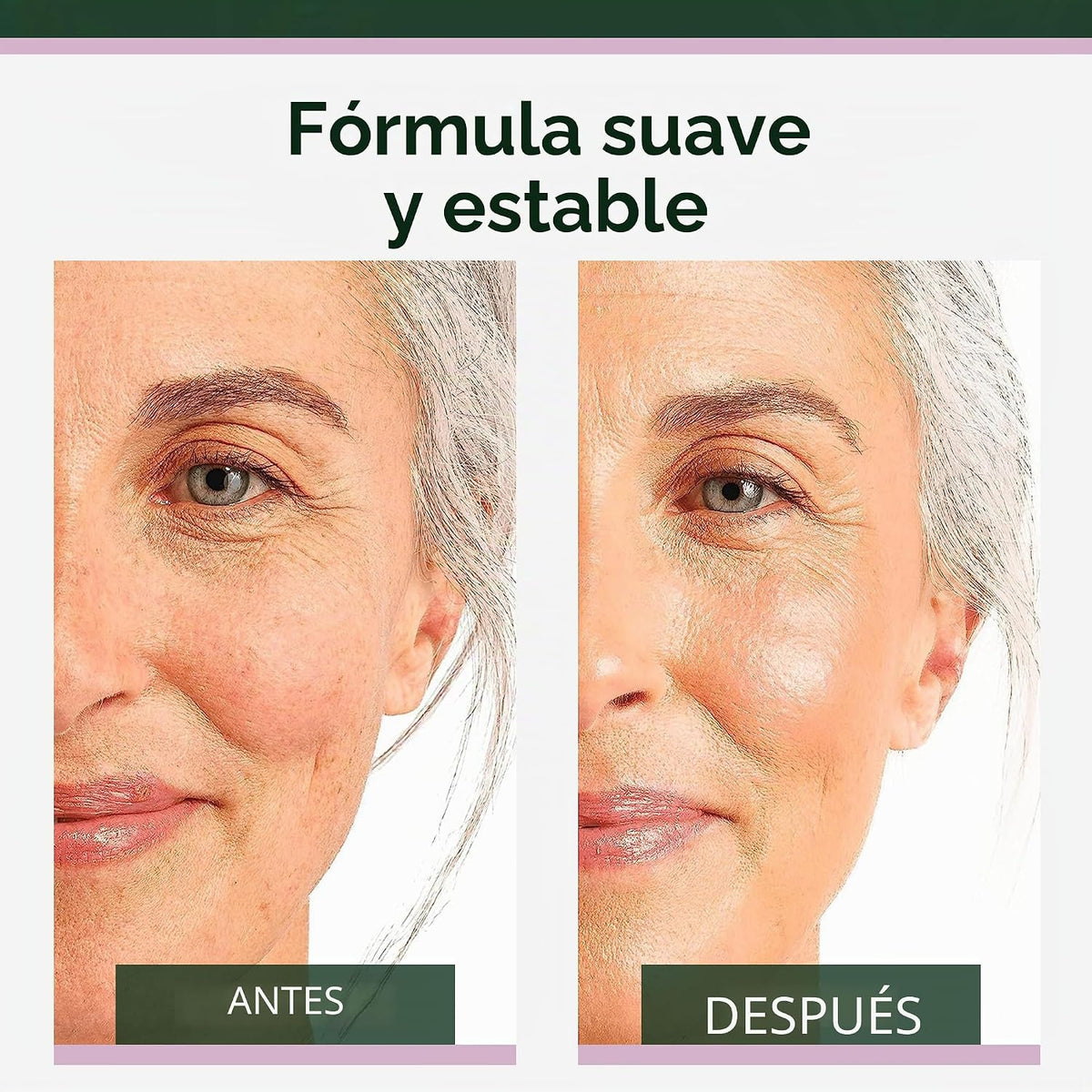 Suero de retinol Tree of Life para rostro, aceite facial antienveje...