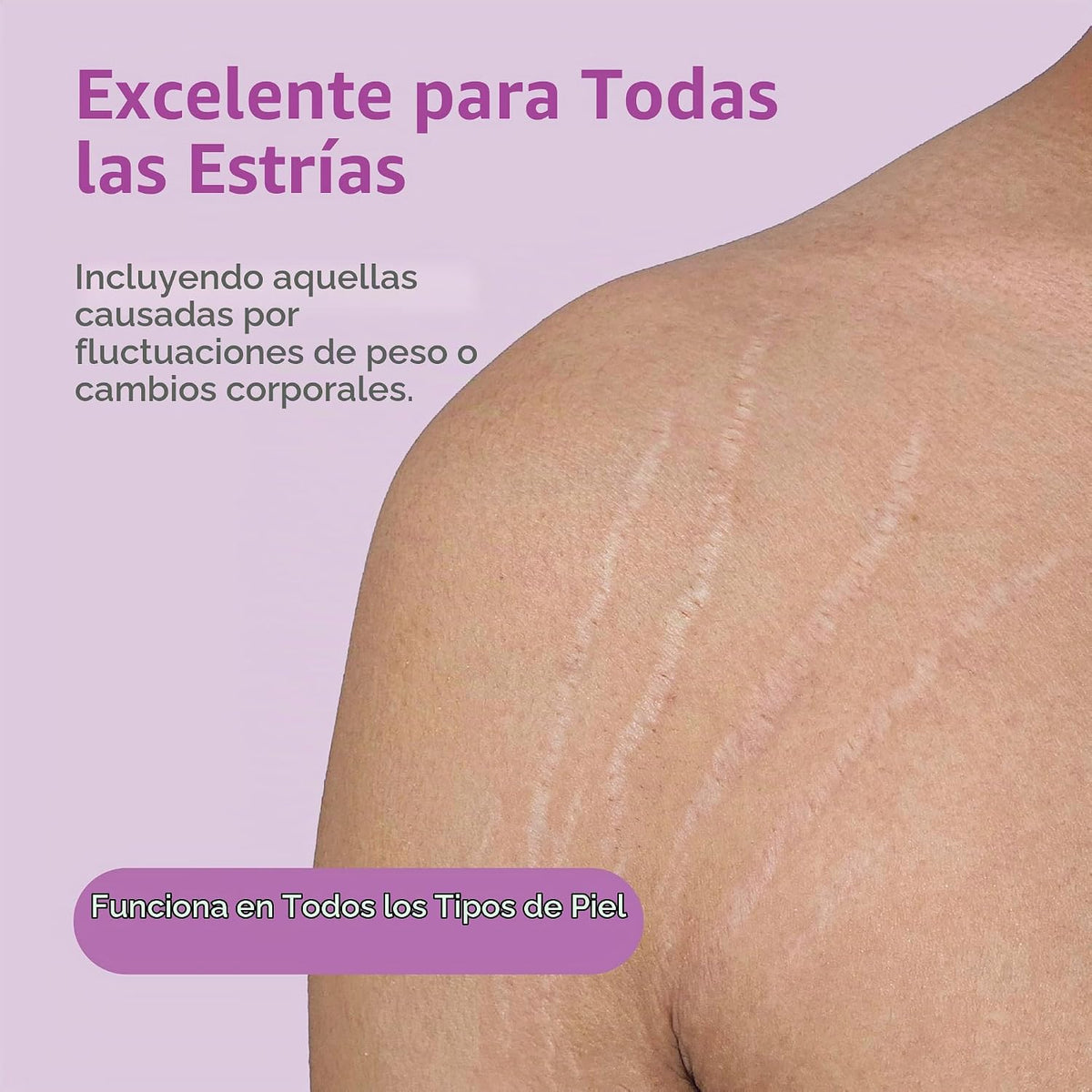 TriLASTIN Crema reafirmante para estrías y acelerador hidrotérmico...