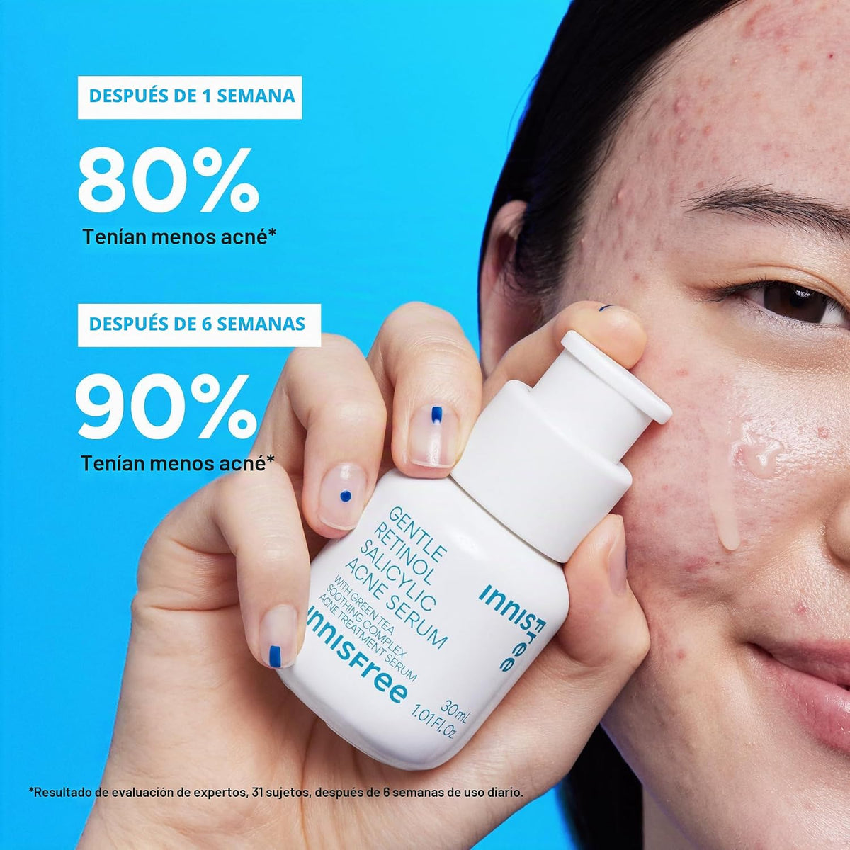 innisfree Suero para acné salicílico suave con retinol | Tratamient...
