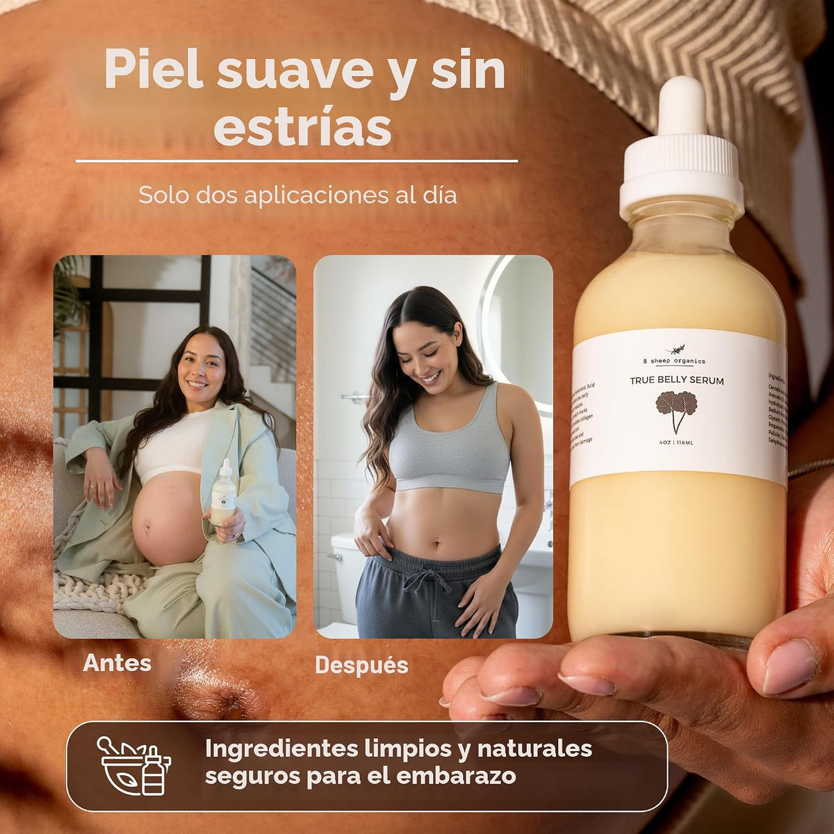 8 Sheep True Belly Serum, aceite para el vientre seguro para el emb...