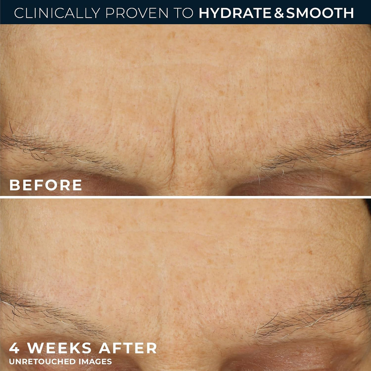 RoC Retinol Correxion Max Hidratación diaria hidratante facial anti...