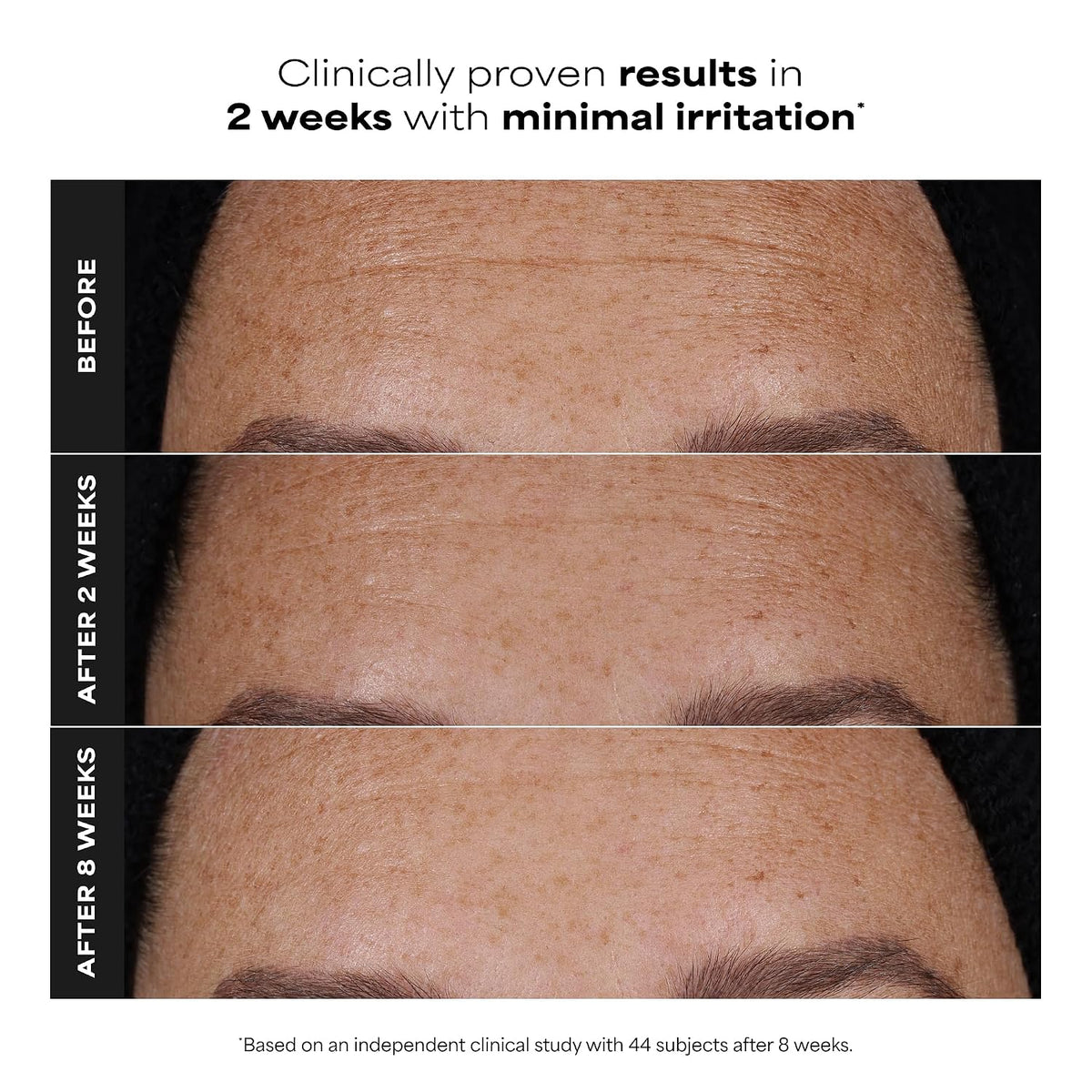 Paula's Choice Suero Facial Pro Retinaldehyde Dual-Retinoide Tr...
