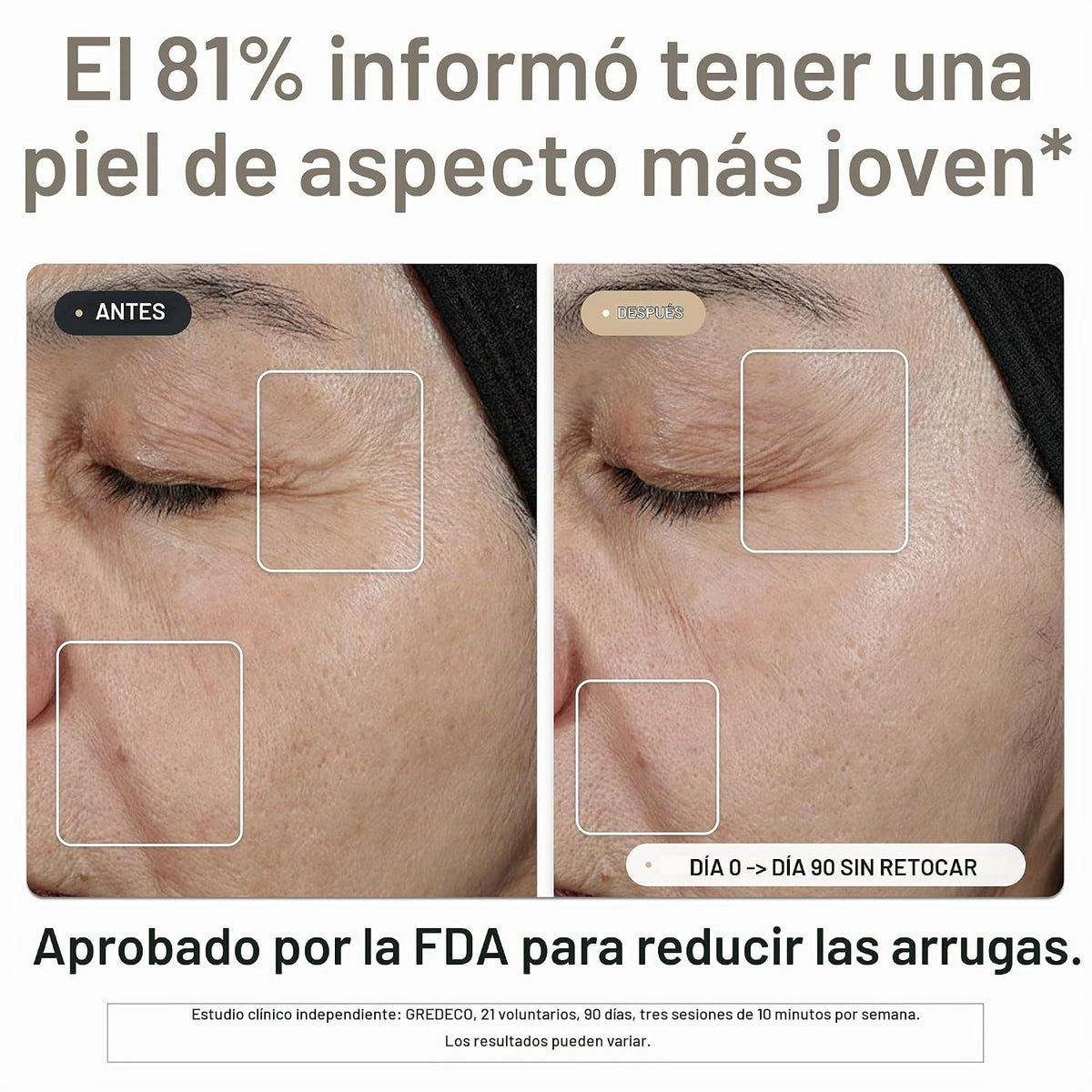 NOOANCE Elite X600 Máscara de terapia de luz roja para cara | 600 L...