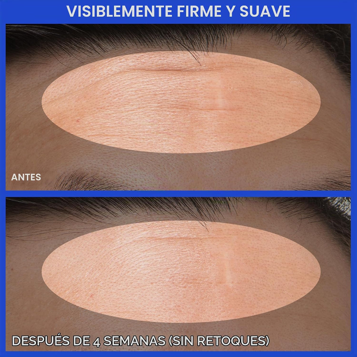 innisfree Suero PDRN de té verde | Cuidado de la piel coreano con r...