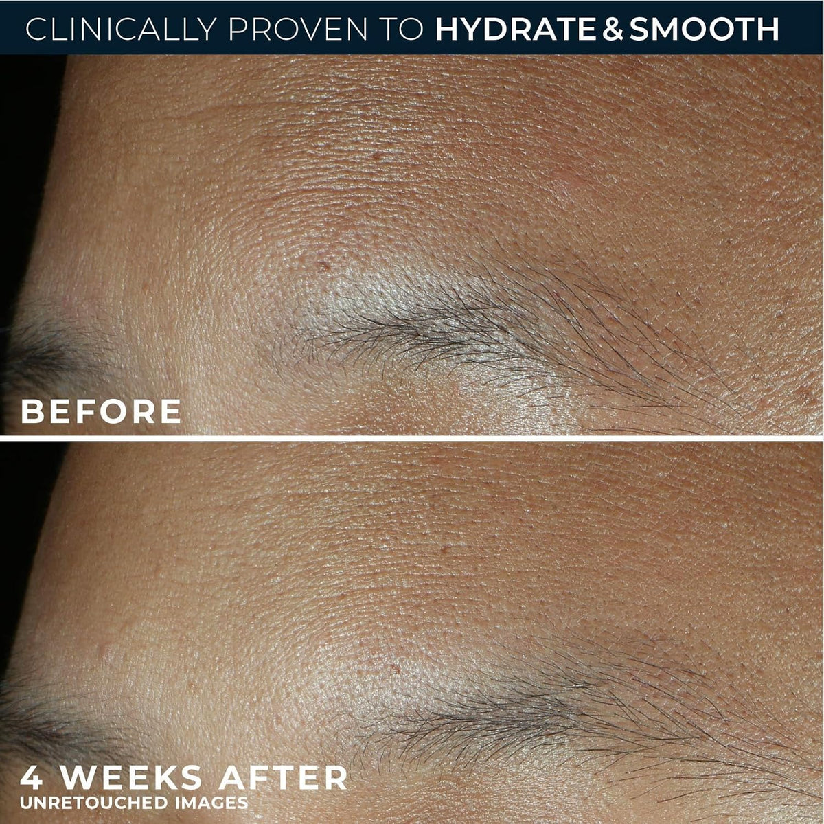 RoC Retinol Correxion Max Hydration - Hidratante facial diario anti...