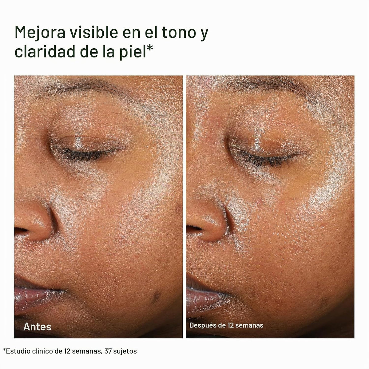 Protector solar facial transparente UV EltaMD con óxido de zinc, si...