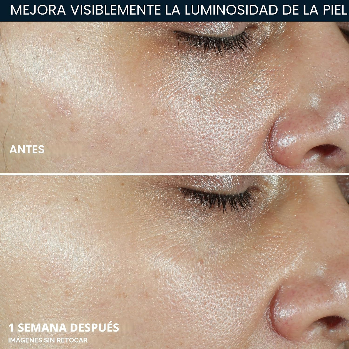 RoC Multi Correxion Vitamina C Protector Solar Amplio Espectro SPF...