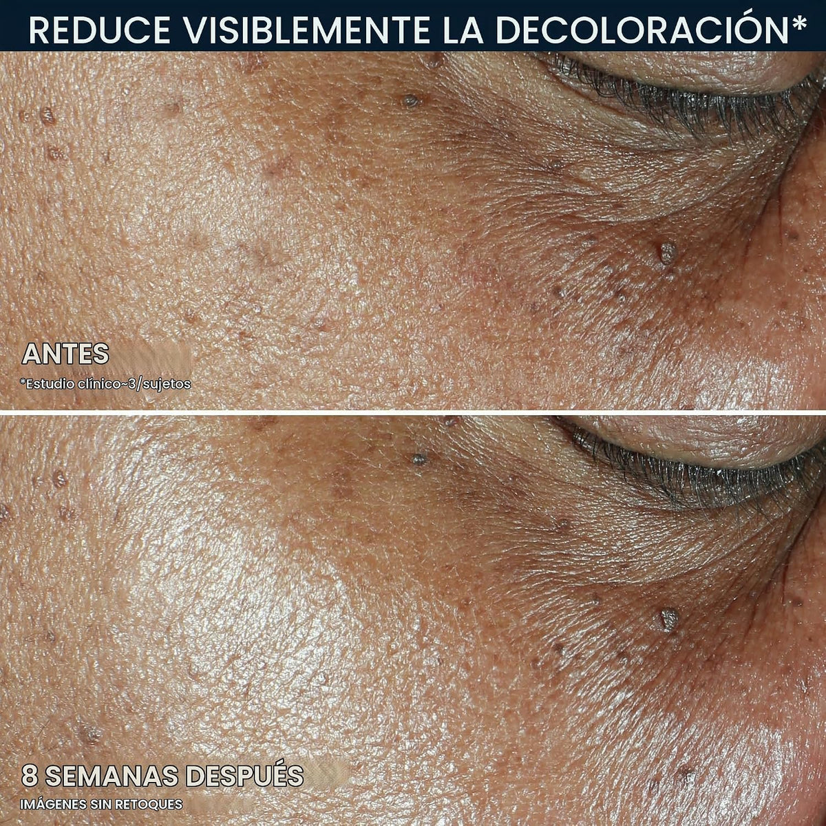 RoC Niacinamide Daily Face Moisturizer SPF 30, tono uniforme 5 en 1...