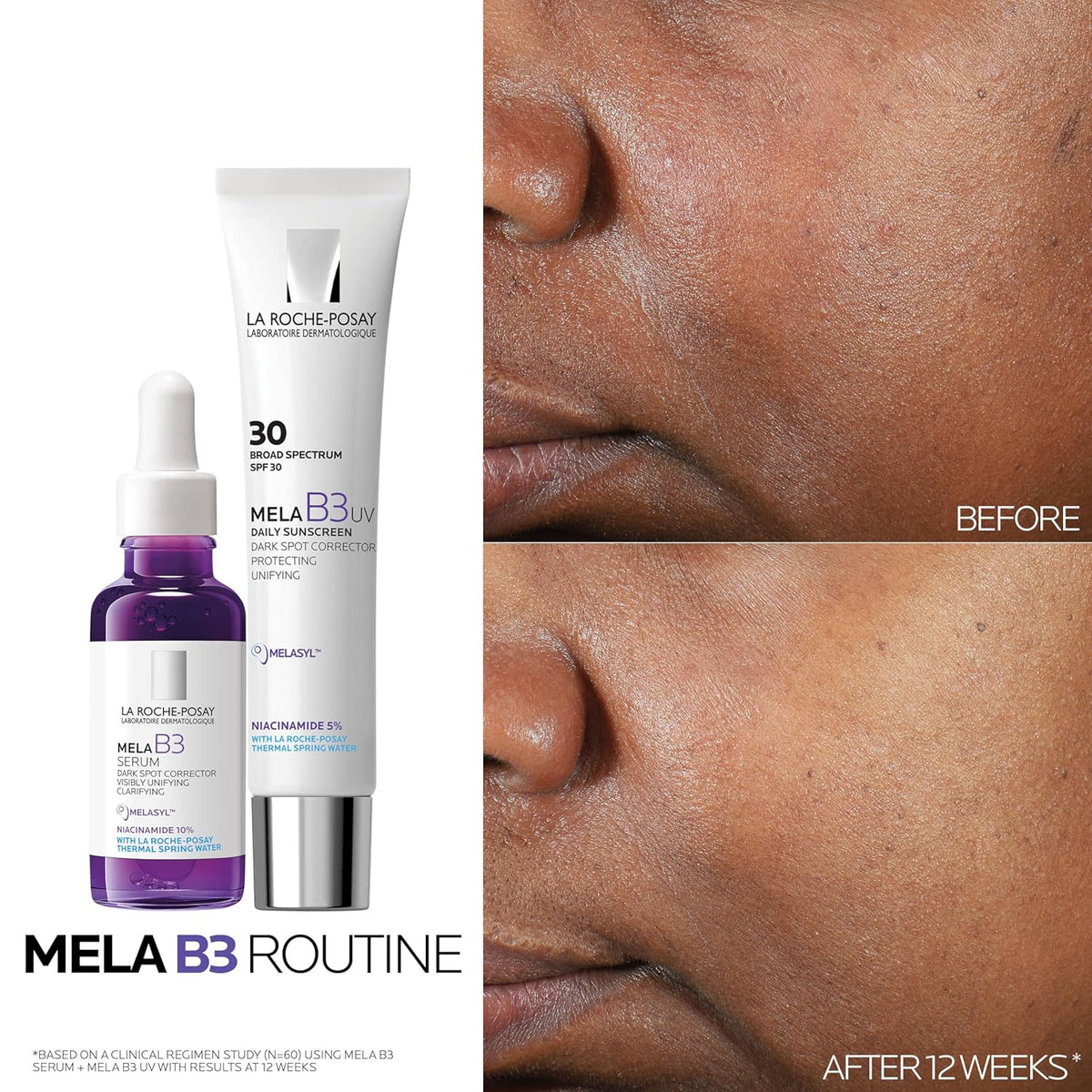 La Roche-Posay Mela B3 Niacinamide Serum, Anti-Aging Dark Spot Corr...
