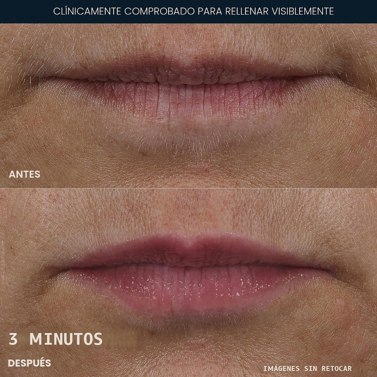 RoC Derm Correxion Voluminizador de labios, suero de labios de ácid...