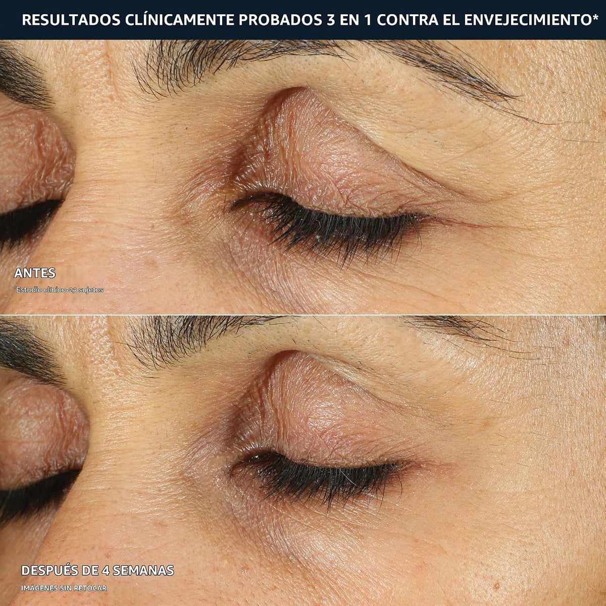 RoC Retinol Correxion - Crema para ojeras e hinchazón, 0.50z | Trat...