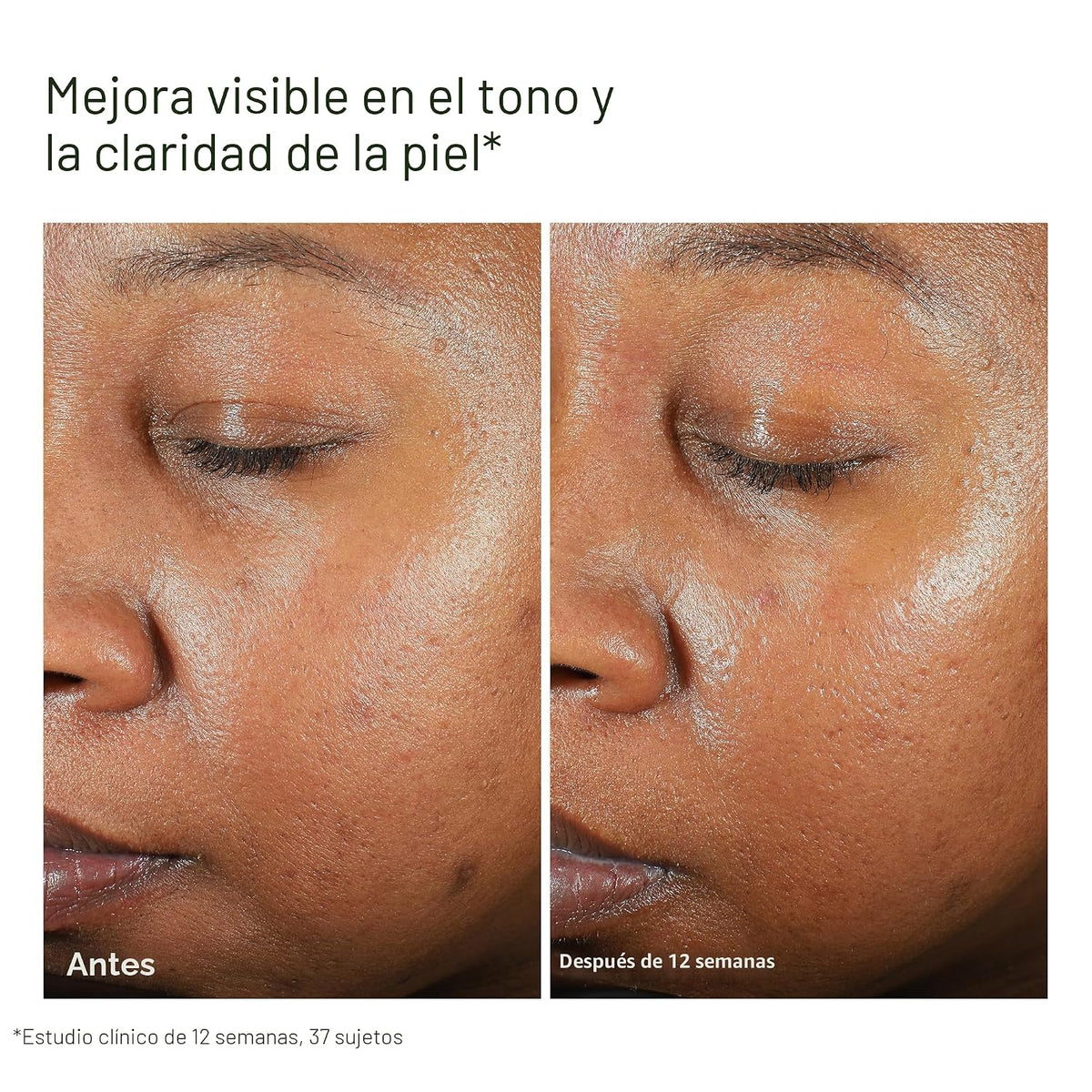 Protector solar facial transparente UV EltaMD con óxido de zinc, si...