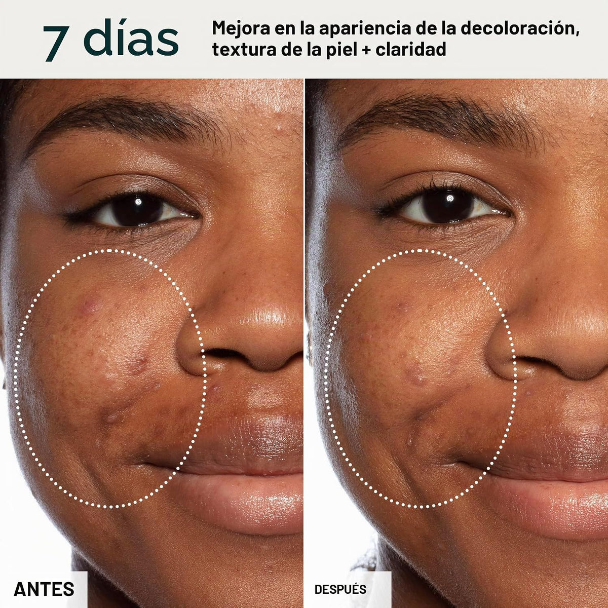 Suero Facial de Tratamiento de Ácido Láctico Todo en Uno de Sunday...