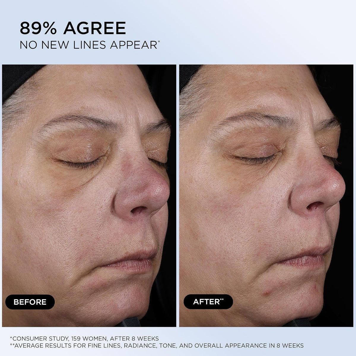 Lancôme Génifique Ultimate Recovery Serum - Suero facial hidratante...