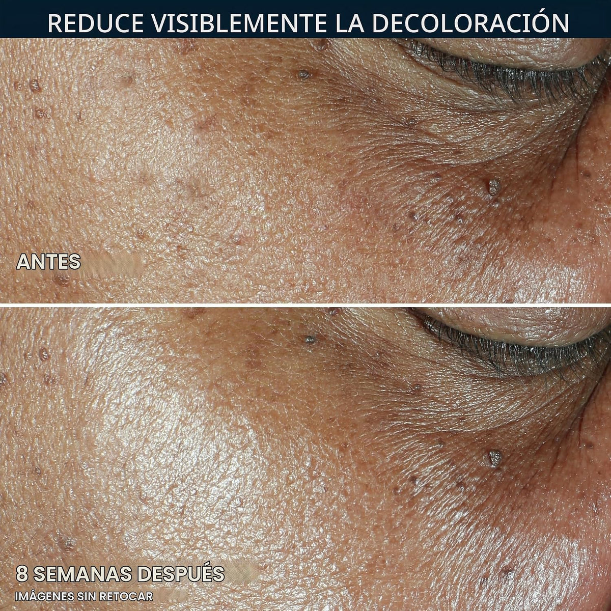 RoC Multi Correxion 5 en 1 hidratante facial diario antienvejecimie...