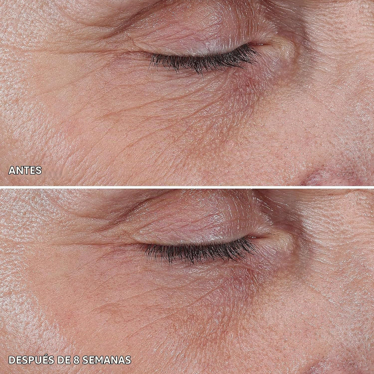 abseits Regenerist - Crema hidratante facial microesculpiente, sin...