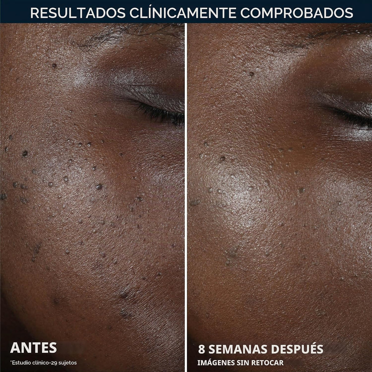 RoC Niacinamide Even Tone + Lift Crema de noche antienvejecimiento,...