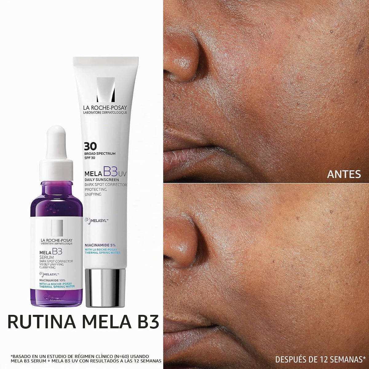 La Roche-Posay Mela B3 Niacinamide Serum, Anti-Aging Dark Spot Corr...