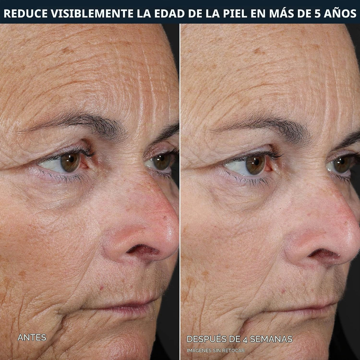 RoC Retinol Correxion Line Suavizar Almohadillas exfoliantes en 2 p...