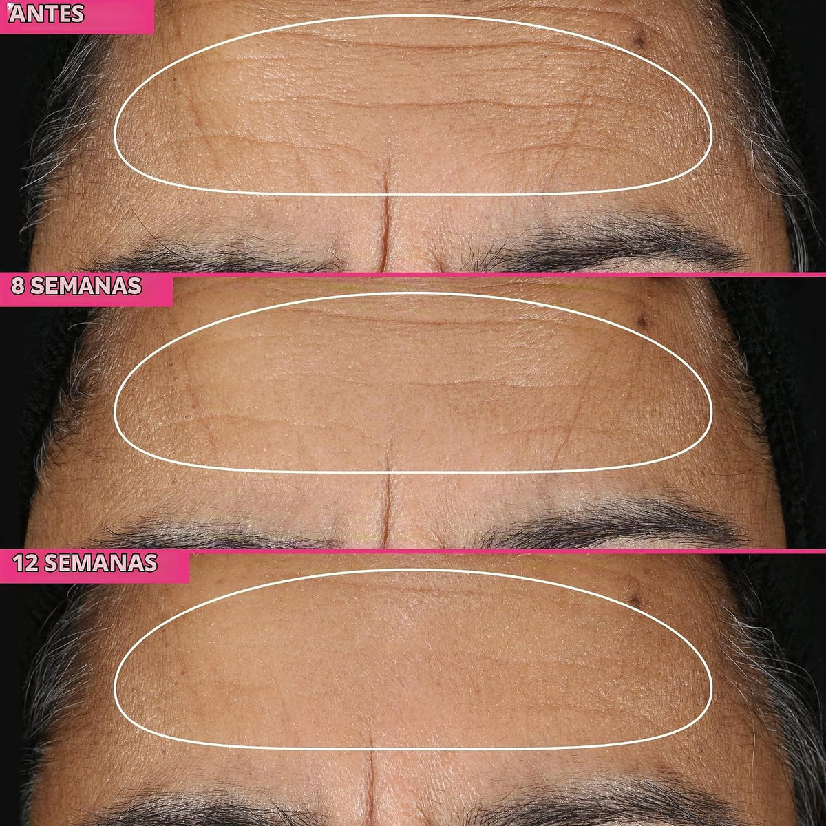 Farmacy Suero de retinol para la cara, 1% de vitamina A antienvejec...