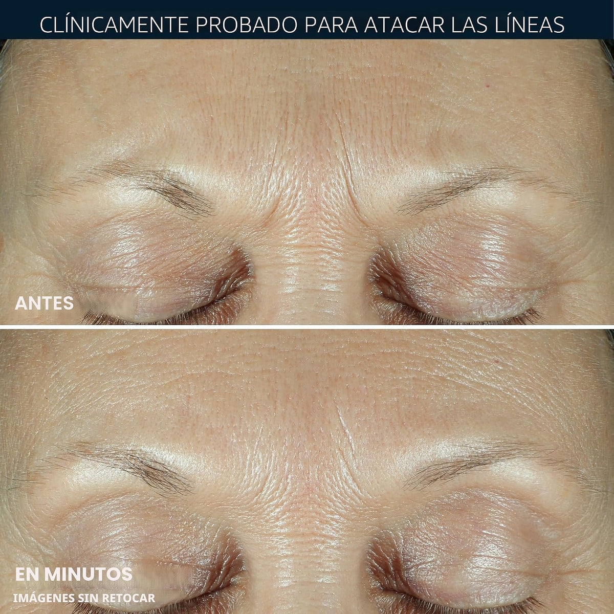 RoC Derm Correxion Fill+Treat Retinol Serum, relleno profundo de ar...