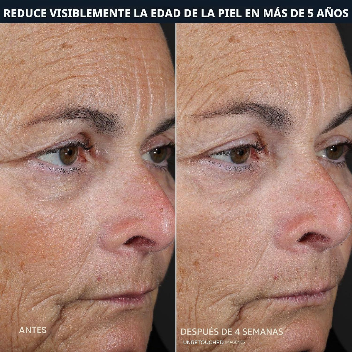 RoC Retinol Correxion Line Smoothing Almohadillas de 2 Pasos - 5 |...