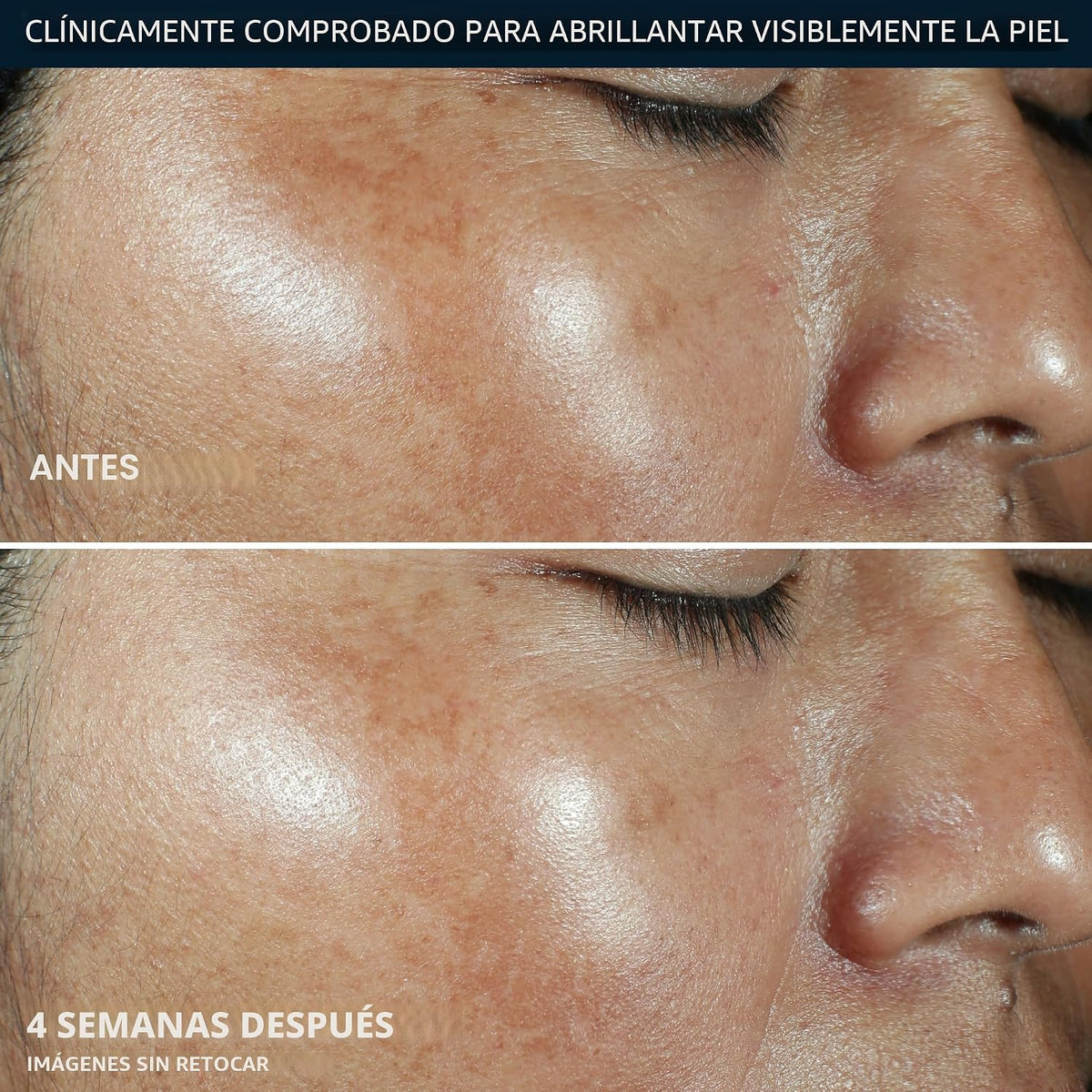 RoC Multi Correxion Vitamina C Protector Solar Amplio Espectro SPF...