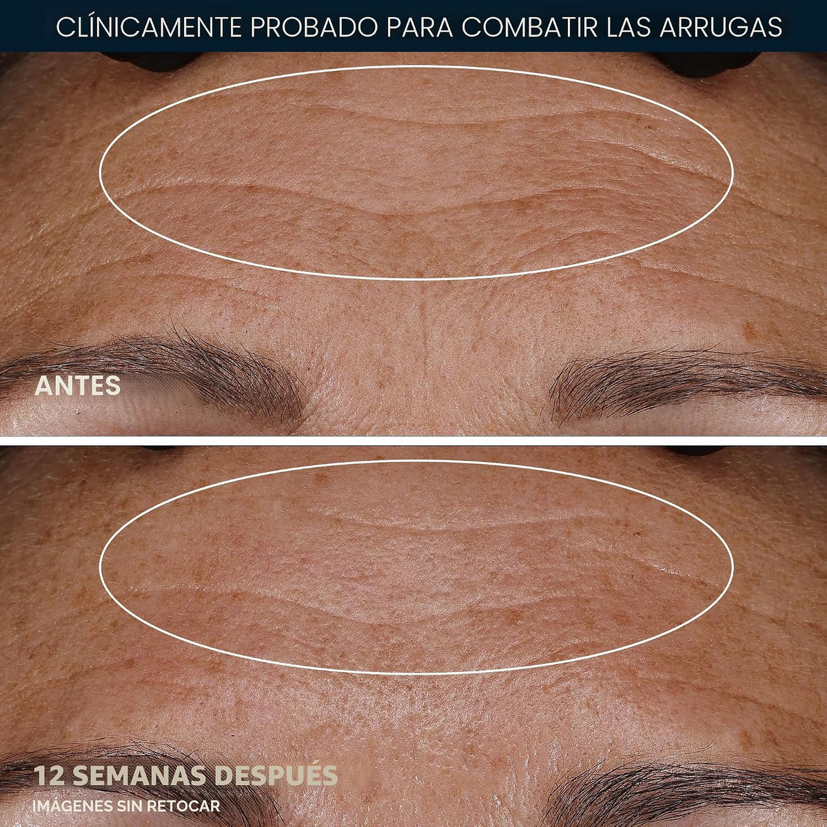 RoC Retinol Correxion Crema de noche antienvejecimiento antiarrugas...