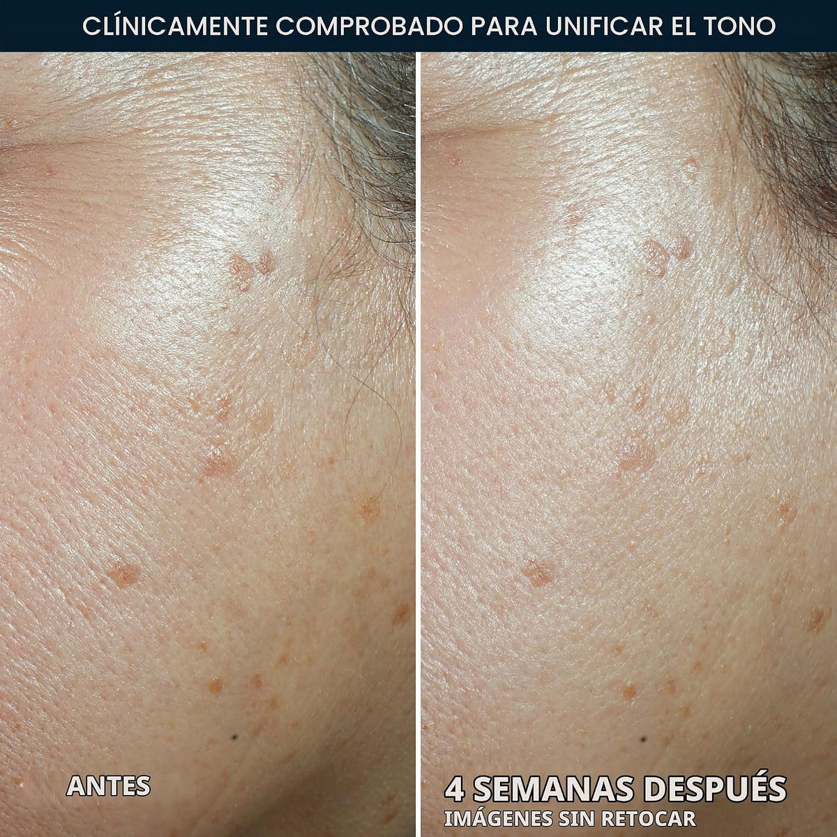 RoC Multi Correxion 5 en 1 hidratante facial diario antienvejecimie...
