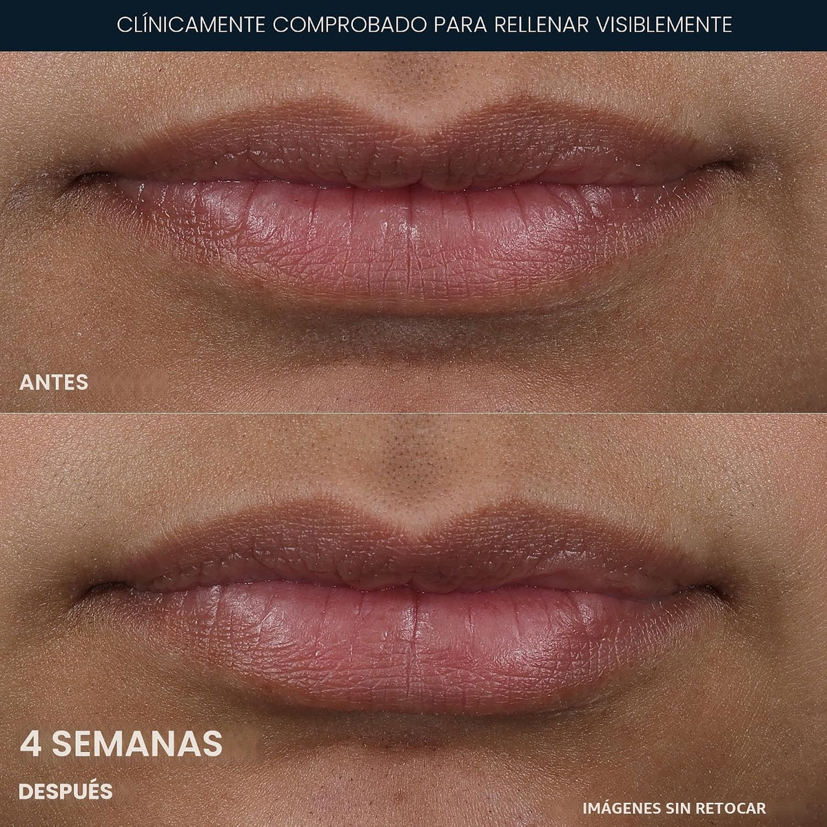 RoC Derm Correxion Voluminizador de labios, suero de labios de ácid...