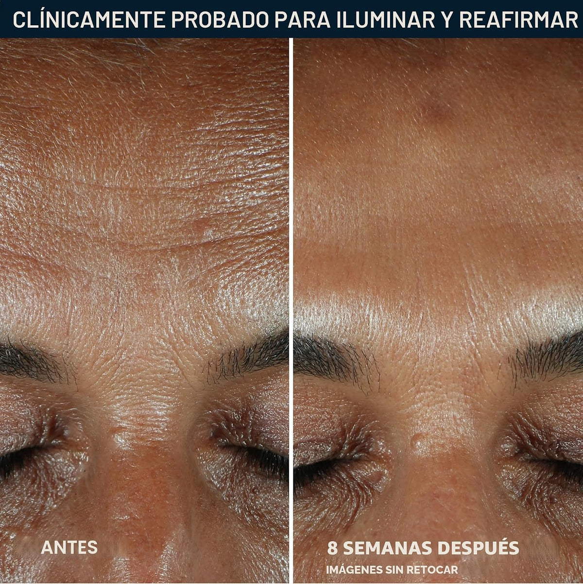 RoC Suero de vitamina C para rostro Multi Correxion Revive + Glow,...