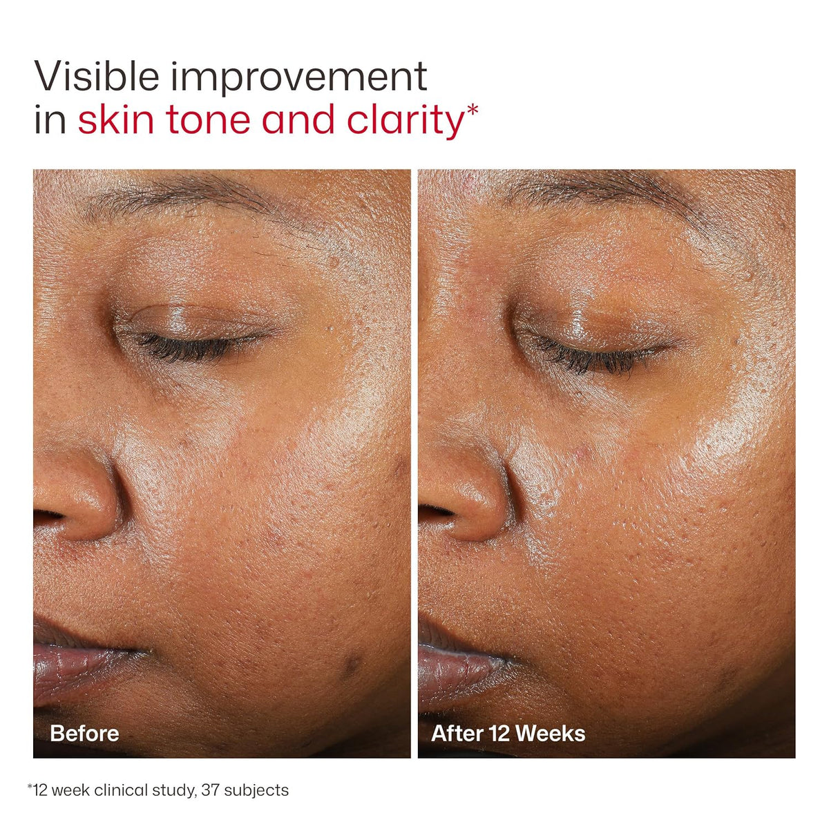 Protector solar facial transparente UV EltaMD con óxido de zinc, si...