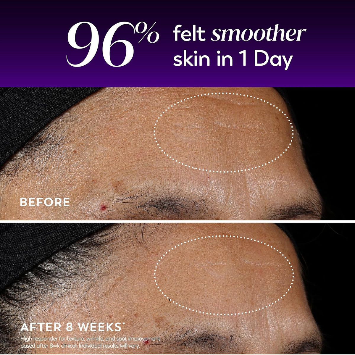 Olay Regenerist - Suero de retinol rejuvenecedor, Renew, suero anti...